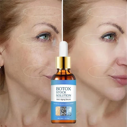 ¡VENTA FLASH CON 40% DESCUENTO - SERUM FACIAL DE BOTOX!