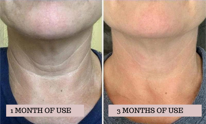 💖 Mother's day Sale - Tighten & Lift Firming Neck Cream