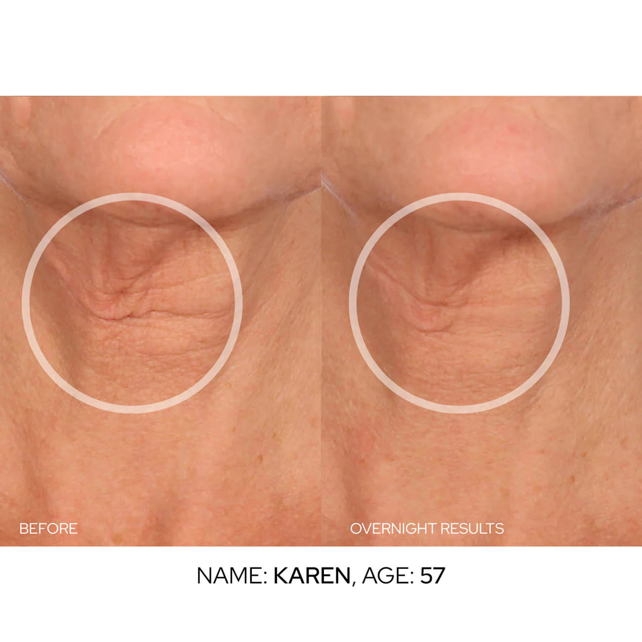 Anti-Aging Patch™, we Transform Your Skin from Home